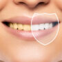 ¿Por qué se amarillean los dientes y cómo solucionarlo de forma segura?